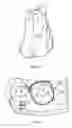 Fig. 08 - METHOD FOR FACILITATING A TOOTH REPOSITIONING DENTAL TREATMENT
