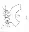 Fig. 08 - Filter and occluder systems and associated methods and devices