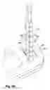 Fig. 09 - Tendon repair apparatus and method