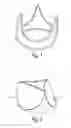 Fig. 02 - Temporary disposable scaffold stand and tools to facilitate reconstructive valve surgery