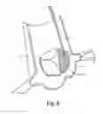 Fig. 07 - Temporary disposable scaffold stand and tools to facilitate reconstructive valve surgery