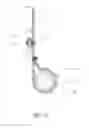Fig. 09 - PROFILE REDUCTION OF VALVE IMPLANT