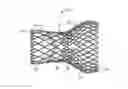 Fig. 01 - Stented prosthetic heart valve with variable stiffness and methods of use