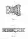 Fig. 02 - Stented prosthetic heart valve with variable stiffness and methods of use