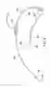 Fig. 06 - Inverting temporary valve sheath