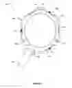 Fig. 08 - Expandable annuloplasty ring and associated ring holder