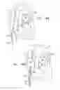Fig. 16 - Controlled steering functionality for implant-delivery tool