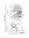 Fig. 20 - Controlled steering functionality for implant-delivery tool