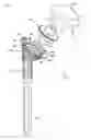 Fig. 01 - Shoulder arthroplasty system