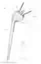 Fig. 02 - Shoulder arthroplasty system