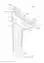 Fig. 06 - Shoulder arthroplasty system