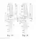 Fig. 07 - Method and system including sleeves and broaches for surgically preparing the patient's bone