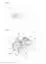 Fig. 02 - Interspinous dynamic implant