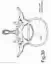 Fig. 45 - Devices and methods for minimally invasive spinal stabilization and instrumentation
