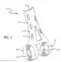 Fig. 02 - Bone joint replacement and repair assembly and method of repairing and replacing a bone joint