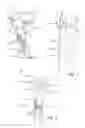 Fig. 06 - Bone joint replacement and repair assembly and method of repairing and replacing a bone joint