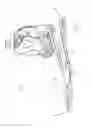 Fig. 02 - Prosthetic joint