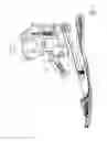 Fig. 07 - Prosthetic joint