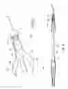 Fig. 07 - Luminal stenting