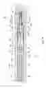Fig. 09 - Luminal stenting