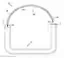 Fig. 01 - FLOATING GASTROINTESTINAL ANCHOR