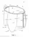 Fig. 02 - Absorbent article having longitudinal direction folded side regions