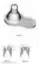 Fig. 02 - Nipple