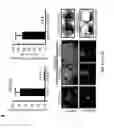 Fig. 45 - Targeting K-Ras-mediated signaling pathways and malignancy by prostratin