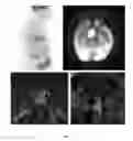 Fig. 03 - COMPOSITIONS AND METHODS FOR TREATING PITUITARY TUMORS