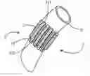 Fig. 01 - Bio-resorbable reticular prosthesis and related manufacturing method
