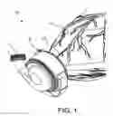 Fig. 02 - Ventricular cuff