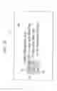 Fig. 43 - Dialysis system including wireless patient data