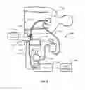 Fig. 02 - Medical reservoir level sensor