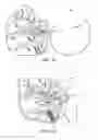 Fig. 06 - Dry powder inhaler