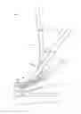 Fig. 07 - CRICOTHYROTOMY INTRODUCER TOOL