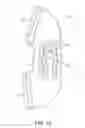 Fig. 40 - Valsalva mask