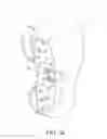 Fig. 43 - Valsalva mask