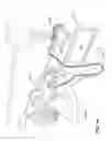 Fig. 02 - Textile patient interface
