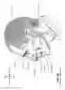 Fig. 08 - Textile patient interface