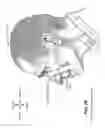 Fig. 09 - Textile patient interface