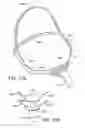 Fig. 45 - Textile patient interface