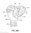 Fig. 72 - Textile patient interface