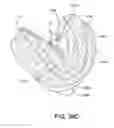 Fig. 85 - Textile patient interface
