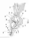 Fig. 06 - Steering control mechanism for catheters