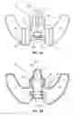 Fig. 02 - Catheter securement device including a guiding nose