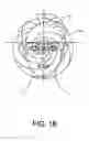 Fig. 03 - COSMETOLOGY DEVICE
