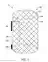 Fig. 04 - IMPLANTABLE MEDICAL DEVICE FOR VASCULAR DEPLOYMENT