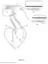 Fig. 02 - Device and method for the treatment of breathing disorders and cardiac disorders