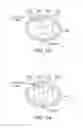 Fig. 13 - Multiple tunable central cathodes on a paddle for increased medial-lateral and rostral-caudal flexibility via current steering