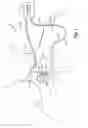 Fig. 02 - AUTOMATIC SELECTION OF LEAD CONFIGURATION FOR A NEURAL STIMULATION LEAD